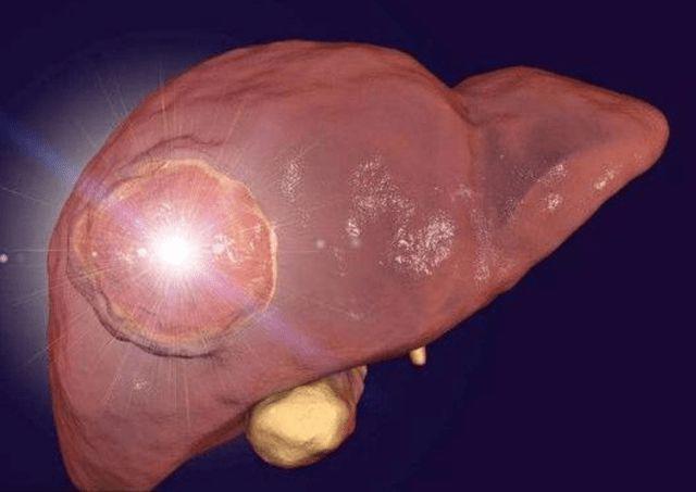 揭秘肝脏病变的诱因养护肝脏必备：这5种水果每天适量享用！